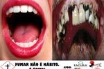 “I Semana FACIMA Contra o Tabagismo”